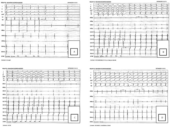 Figure 32