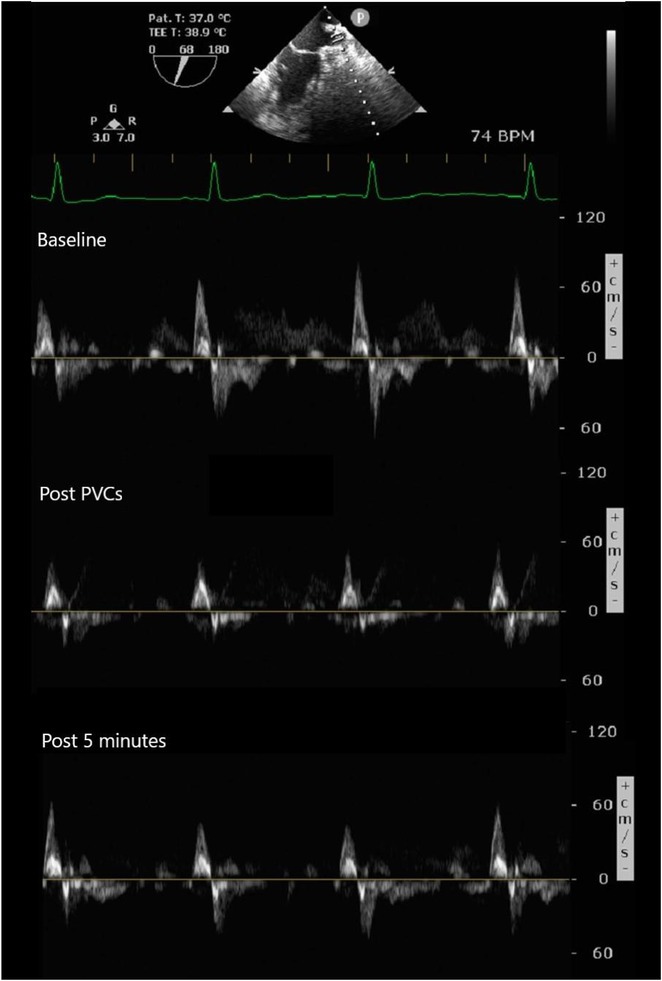 Figure 33