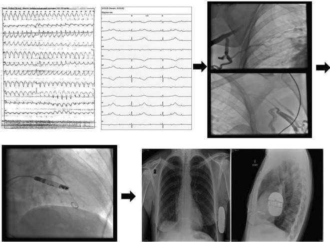 Figure 35