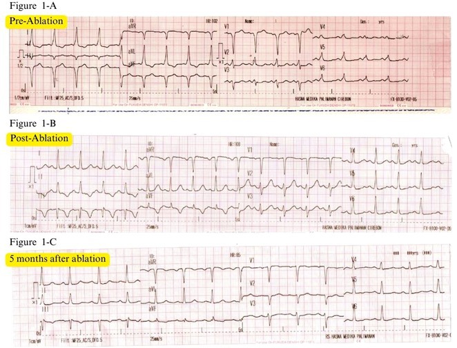 Figure 36