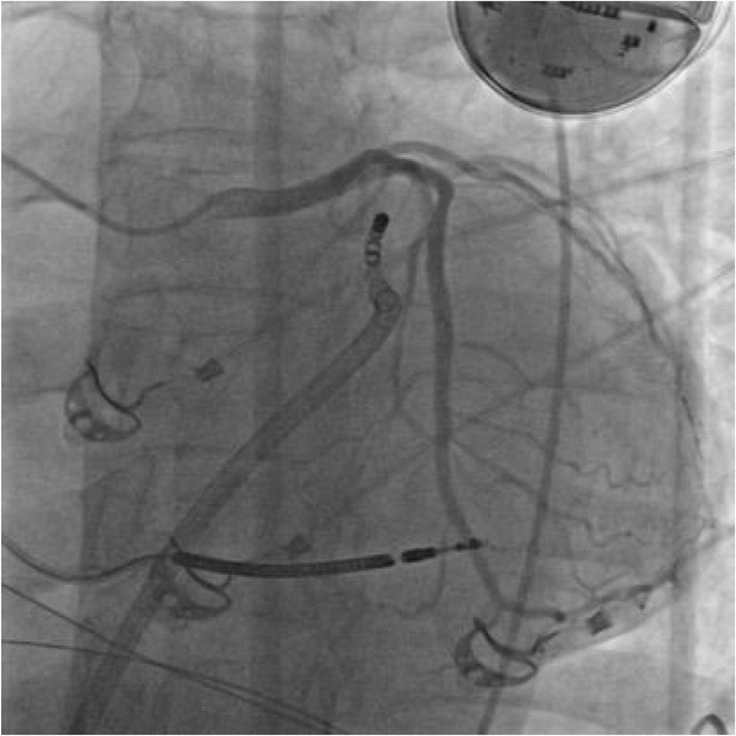 Figure 37