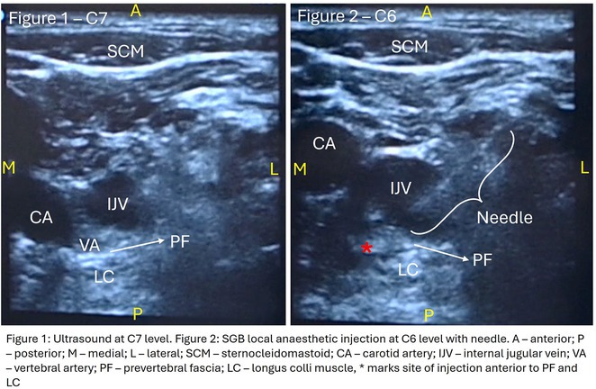 Figure 38
