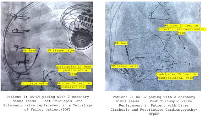 Figure 39