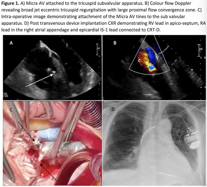 Figure 43