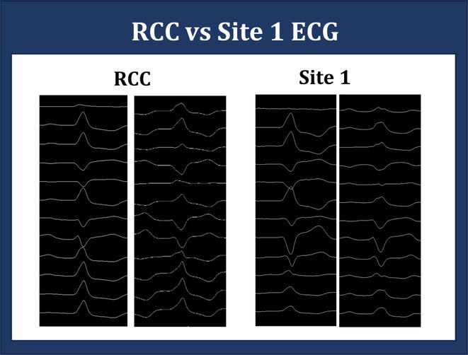 Figure 45