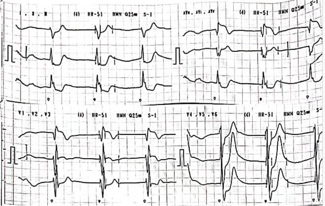 Figure 47