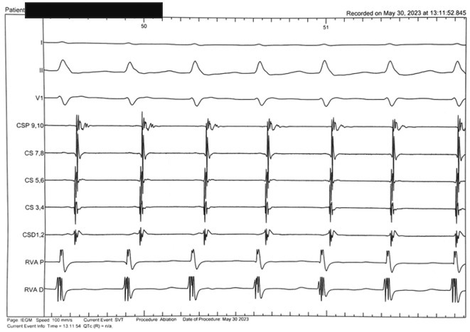 Figure 49