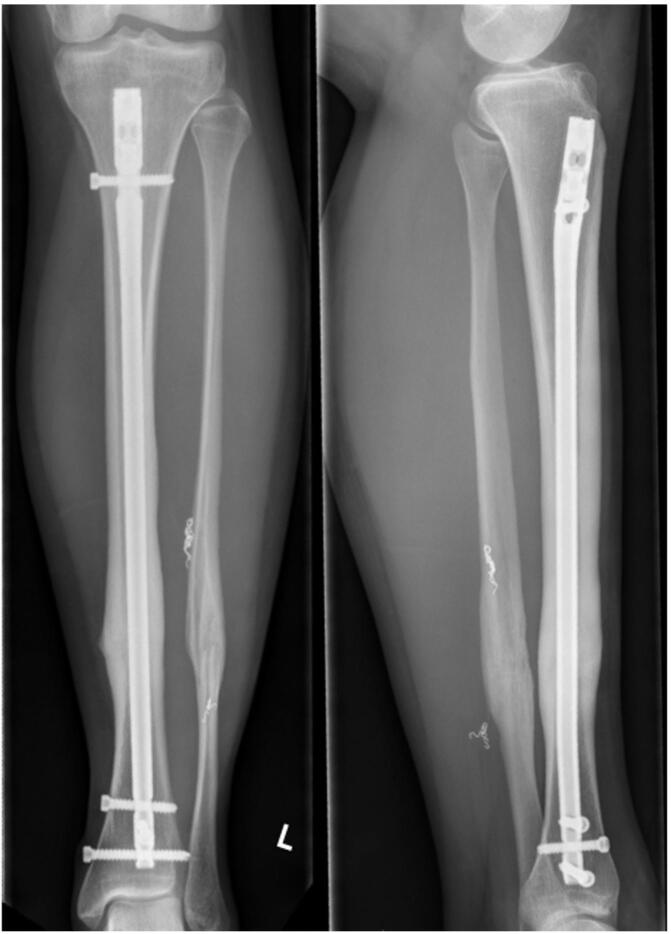 Figure 4