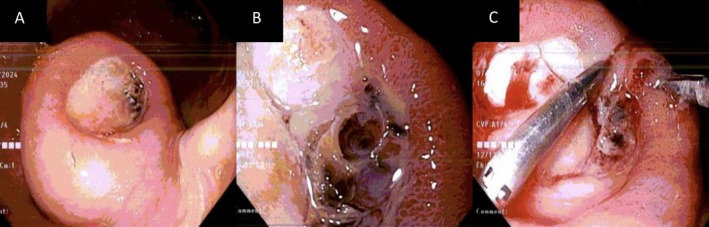 FIGURE 1