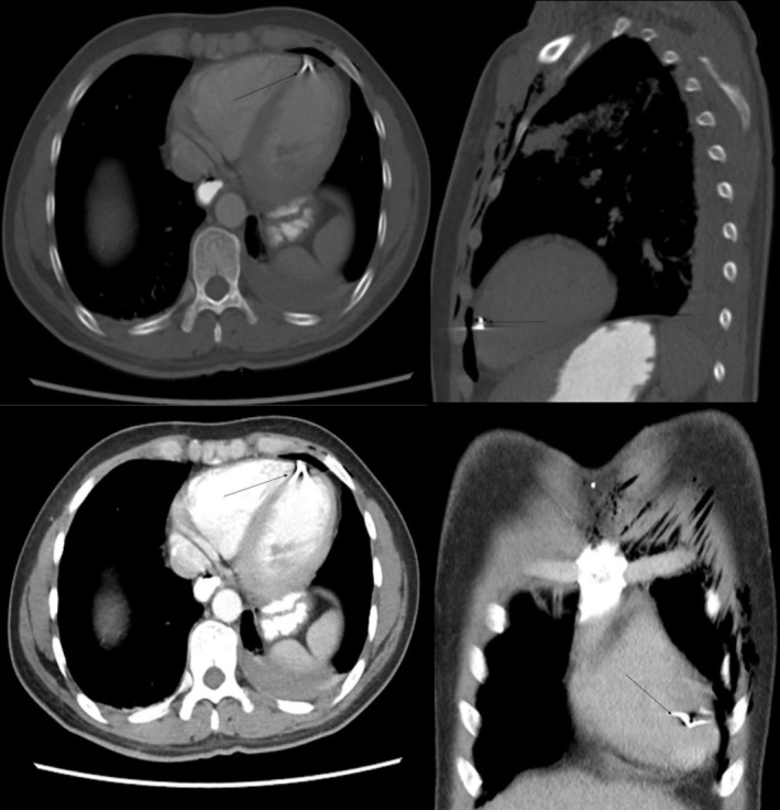 FIGURE 1