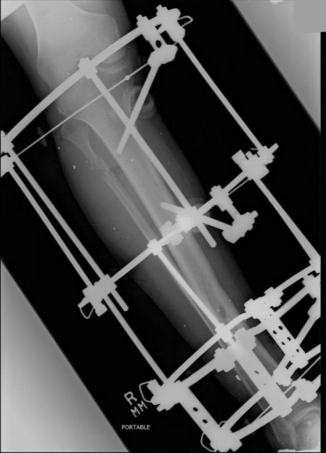 FIGURE 3