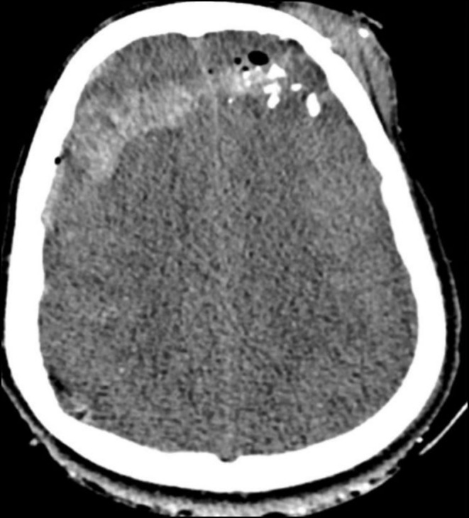 FIGURE 4