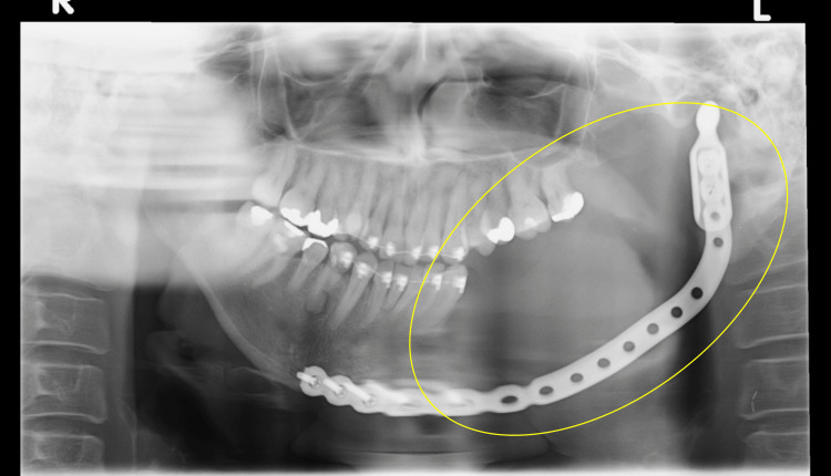 Figure 9