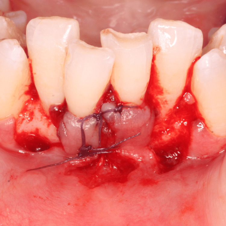 Figure 7