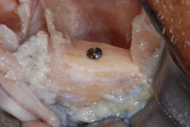 Figure 18