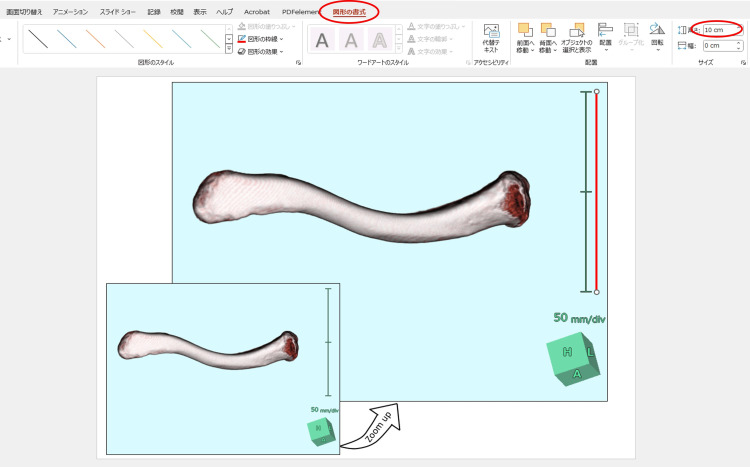 Figure 11
