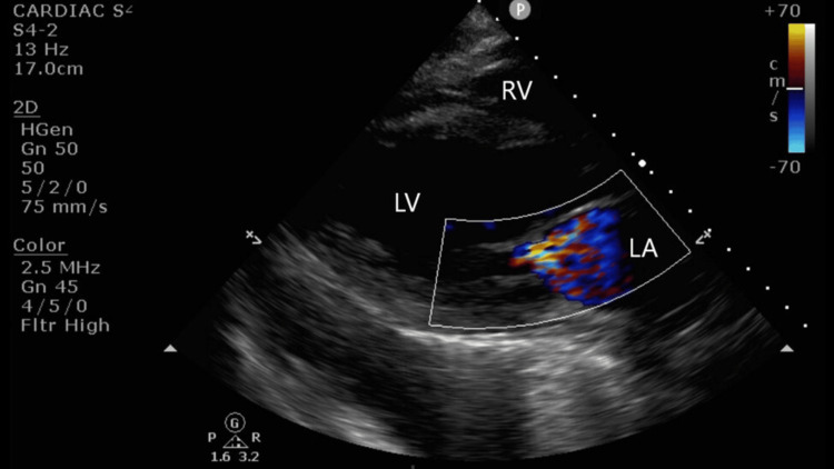 Figure 2