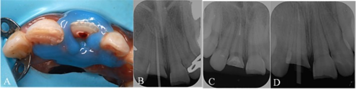 FIGURE 4