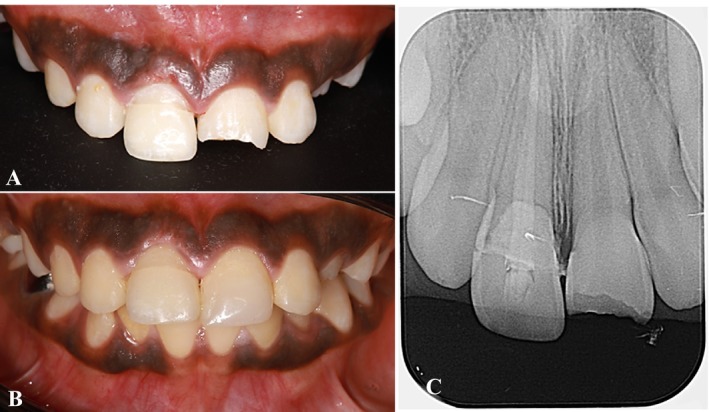 FIGURE 9