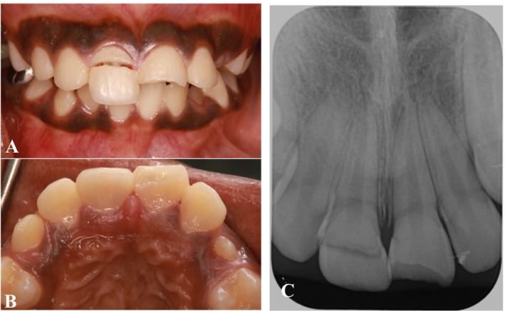 FIGURE 1