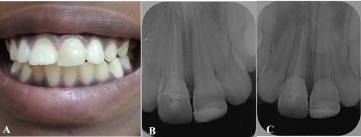FIGURE 11