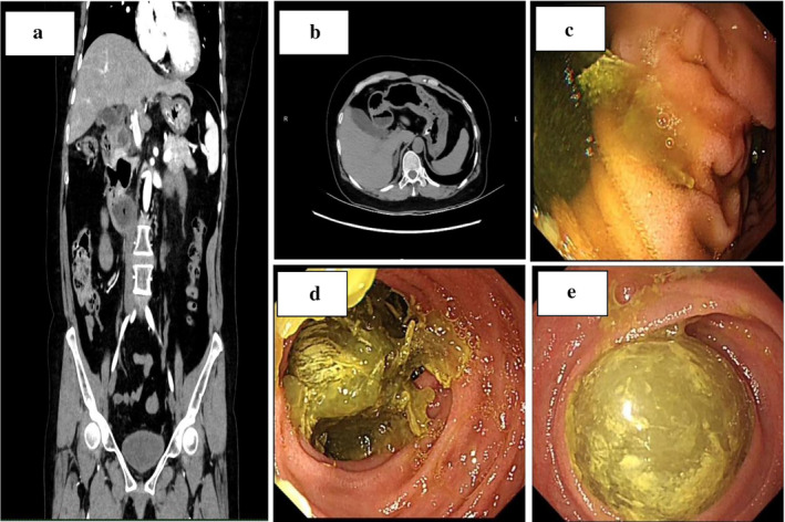 FIGURE 1