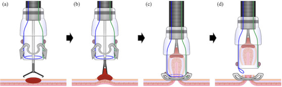 FIGURE 6