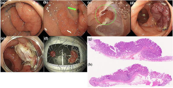 FIGURE 4