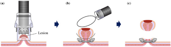 FIGURE 1