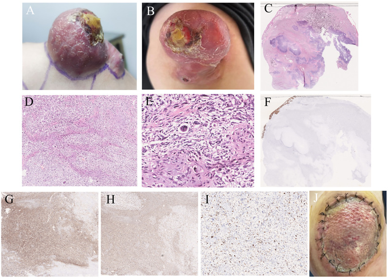 Figure 1