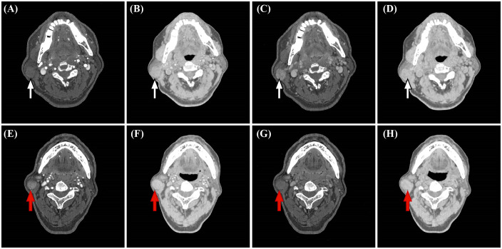 Figure 3