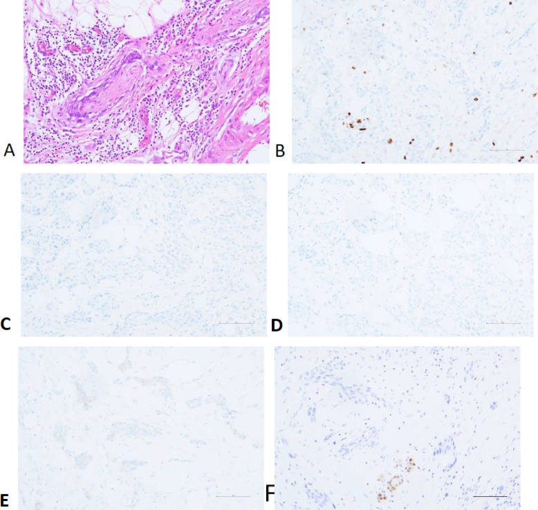 Figure 2