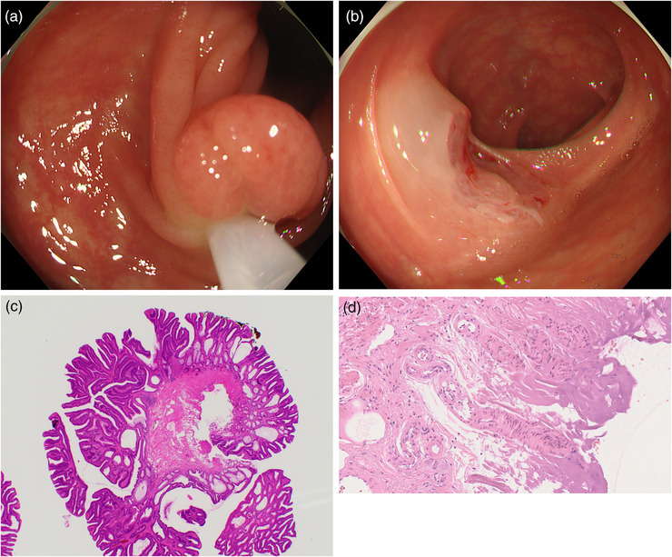 FIGURE 2