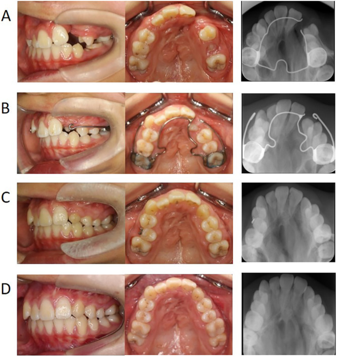 FIGURE 1