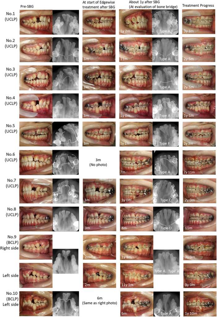 FIGURE 4