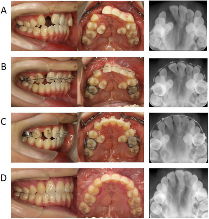 FIGURE 2