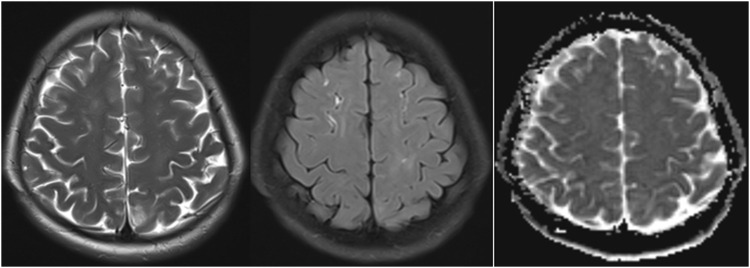 FIGURE 3