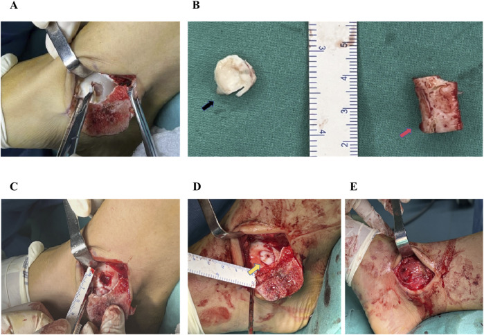 FIGURE 1