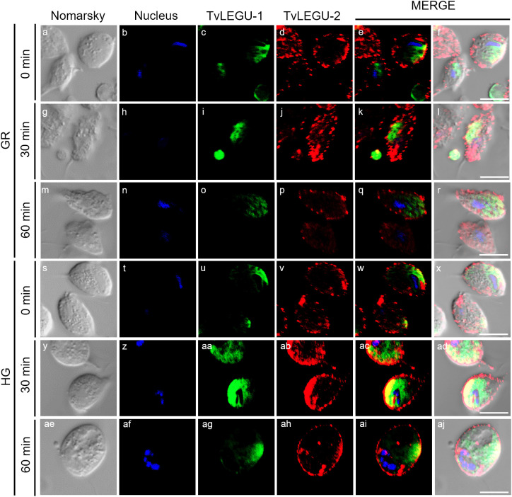 Figure 11
