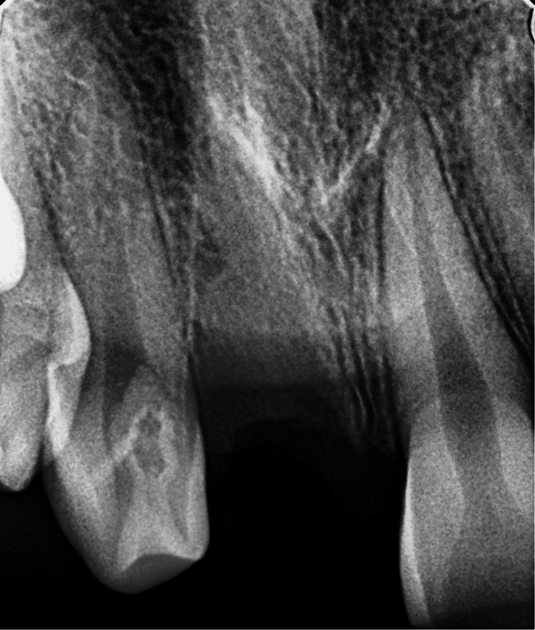 Figure 16
