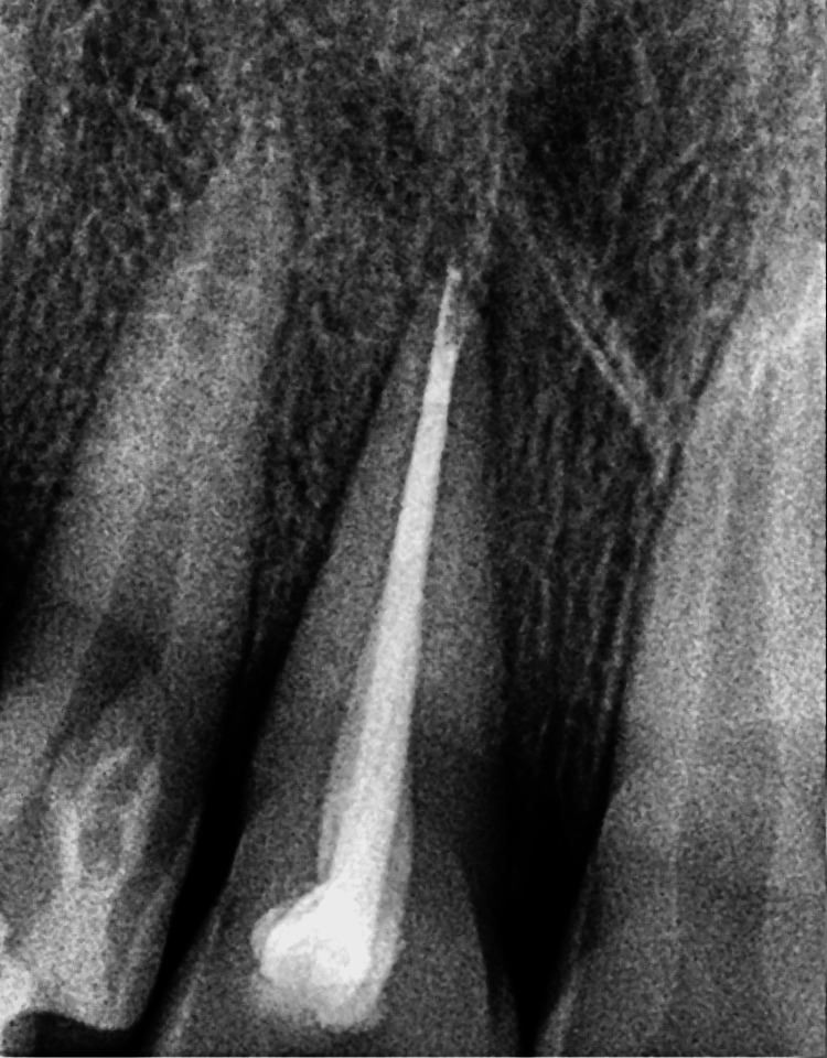 Figure 20