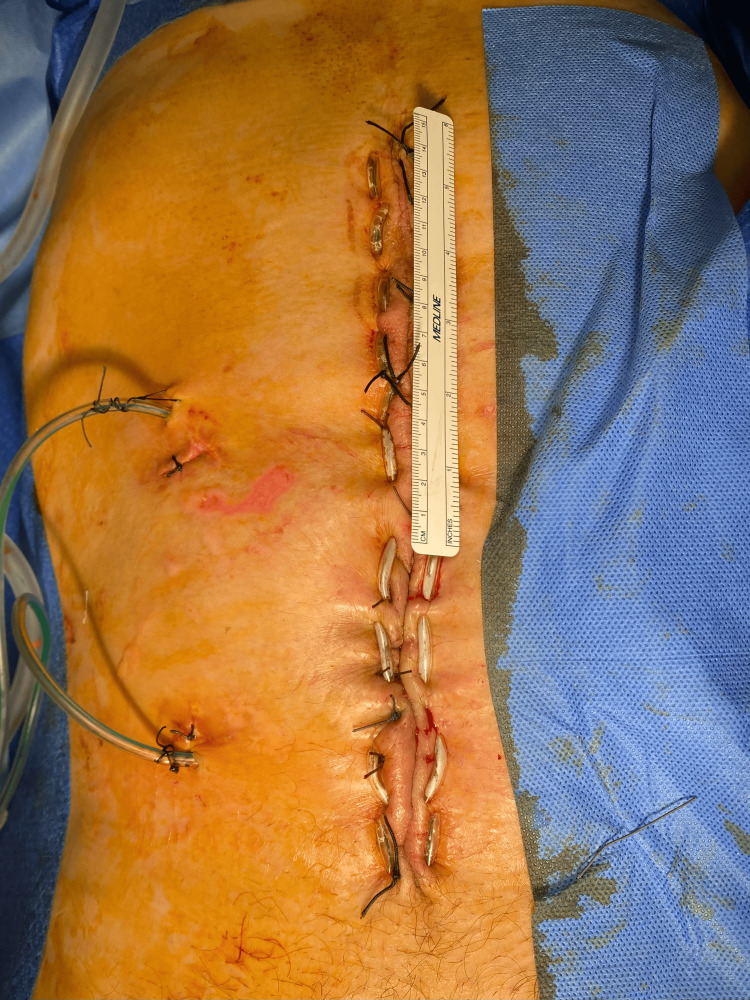 Figure 14