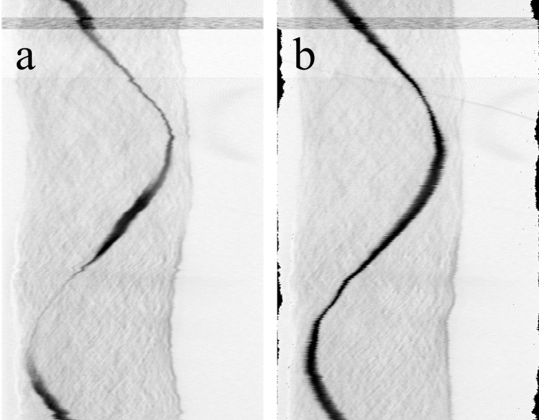 Fig 11