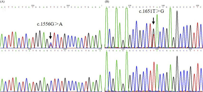 FIGURE 3