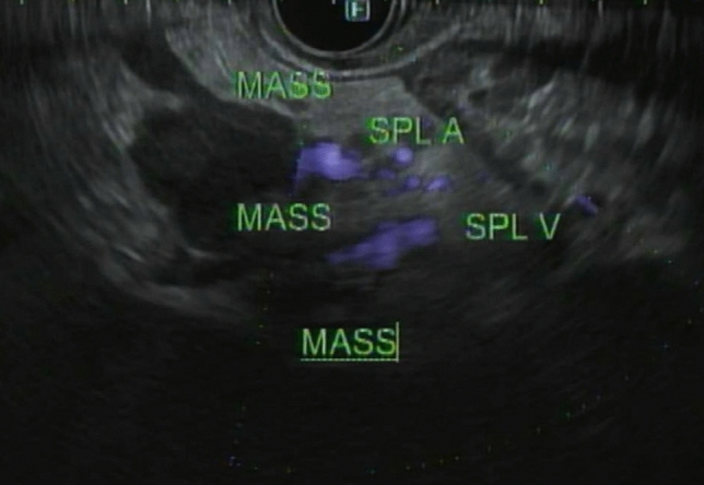 Figure 10