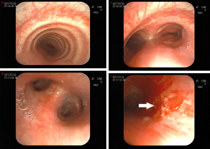 FIGURE 4