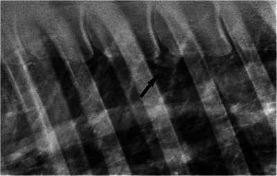 FIGURE 4