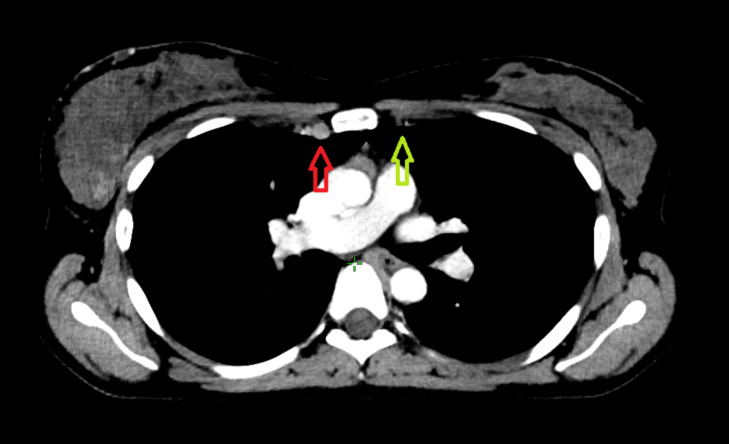Figure 3