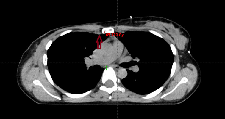 Figure 4
