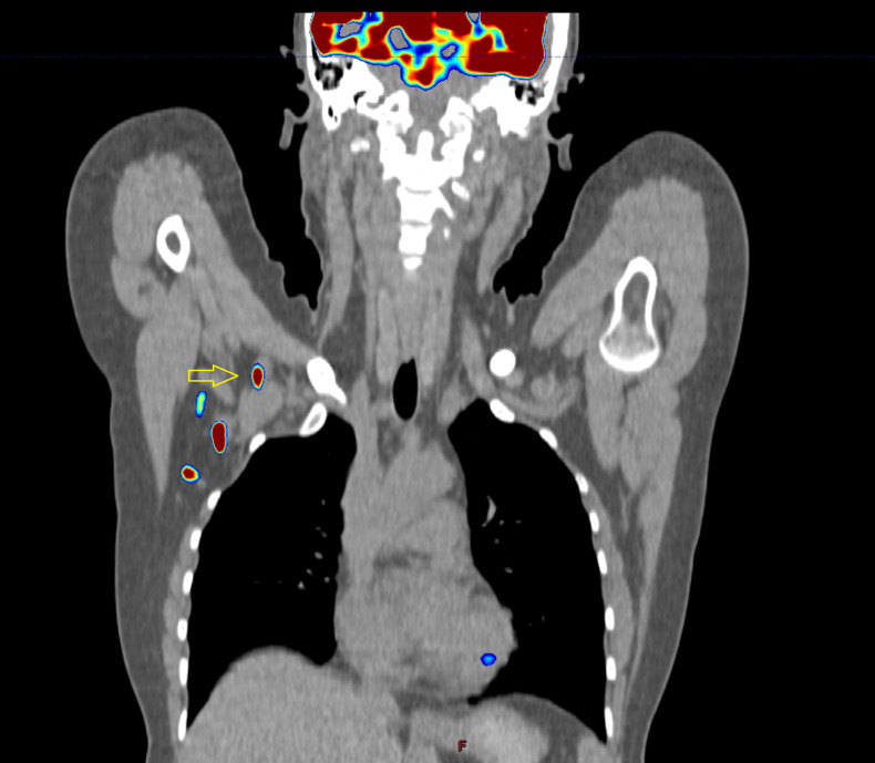 Figure 6